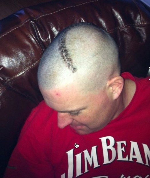 Jamie scar2x